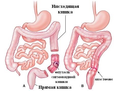59774b5430d4e.jpg